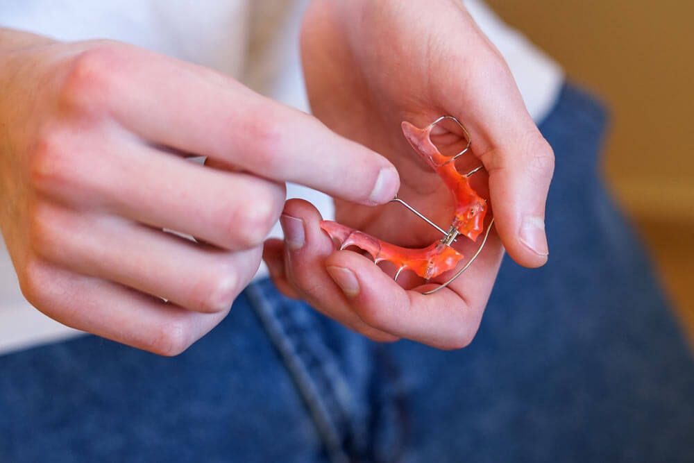 Palatal Expanders- A