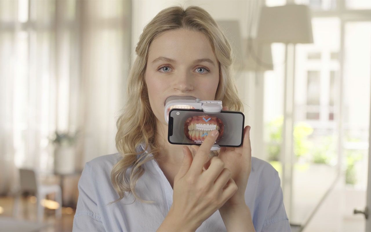Remote Aligner Check-ins with Dental Monitoring
