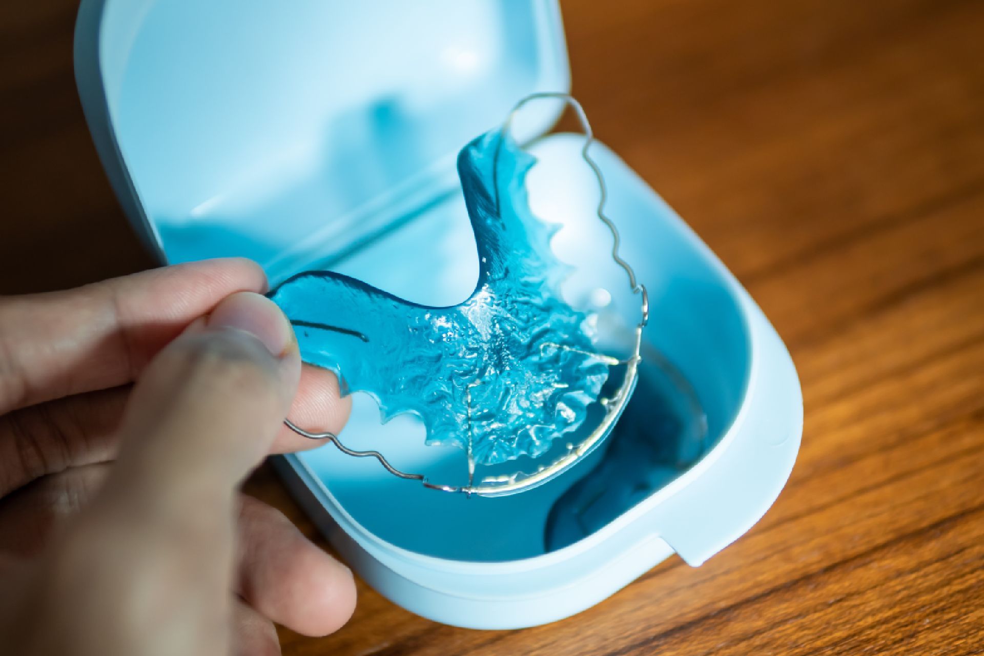 Retainers & Fast Replacement
