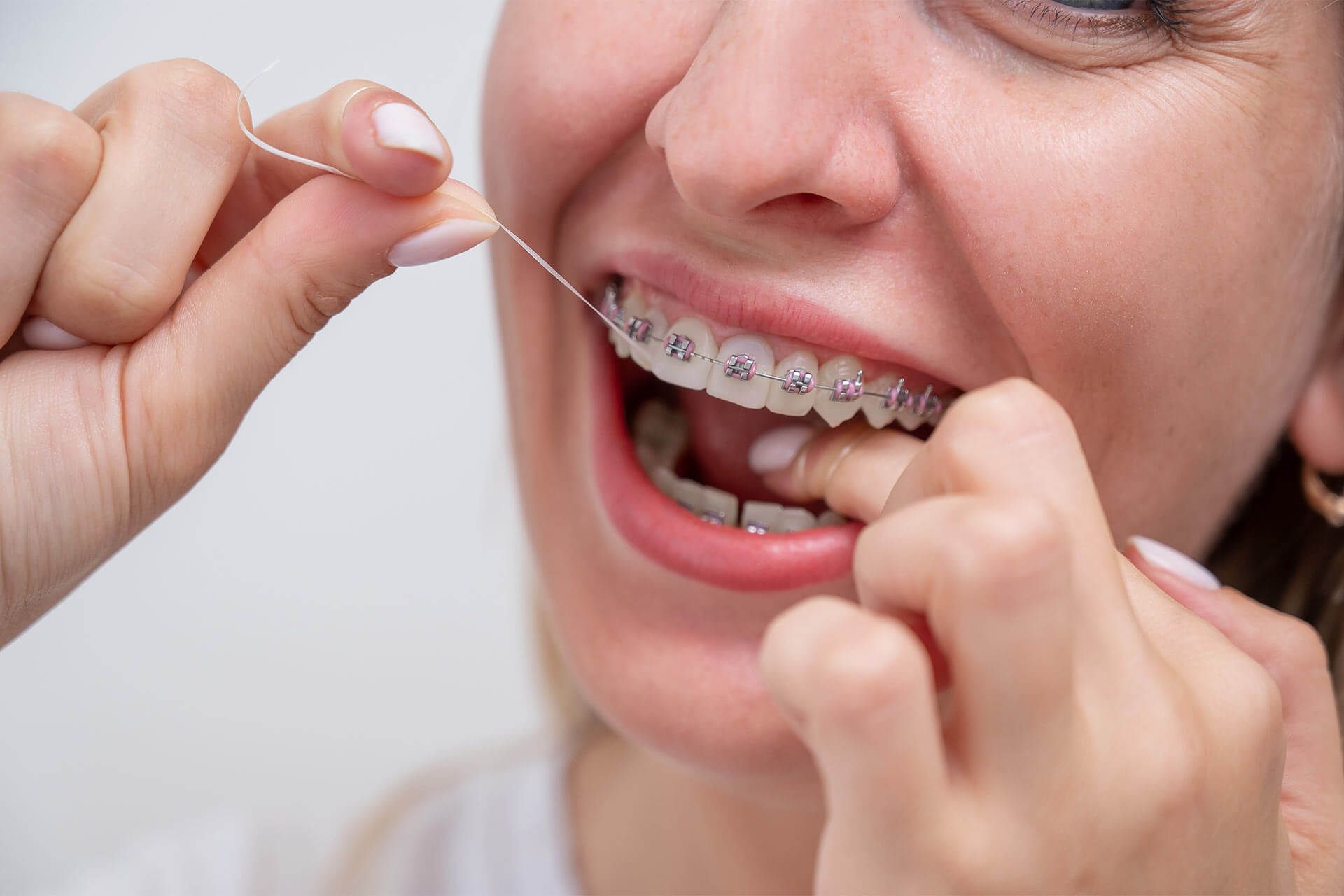 Comprehensive Guide to Flossing