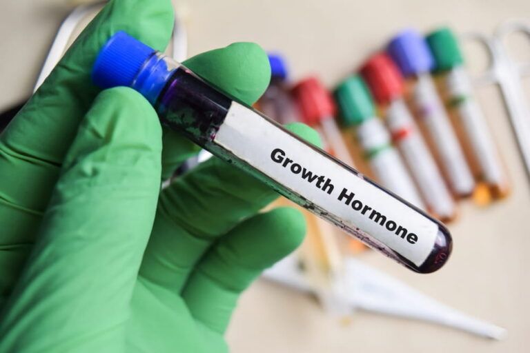 Growth Hormone - Test with blood sample in green gloved hands. healthcare or Medical concept