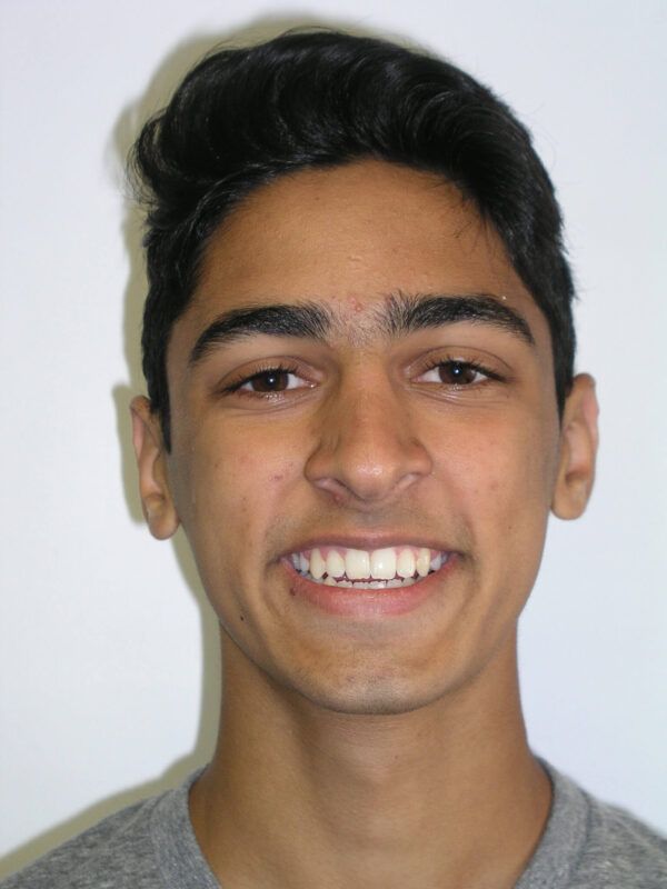 Adolescent Comprehensive Treatment After