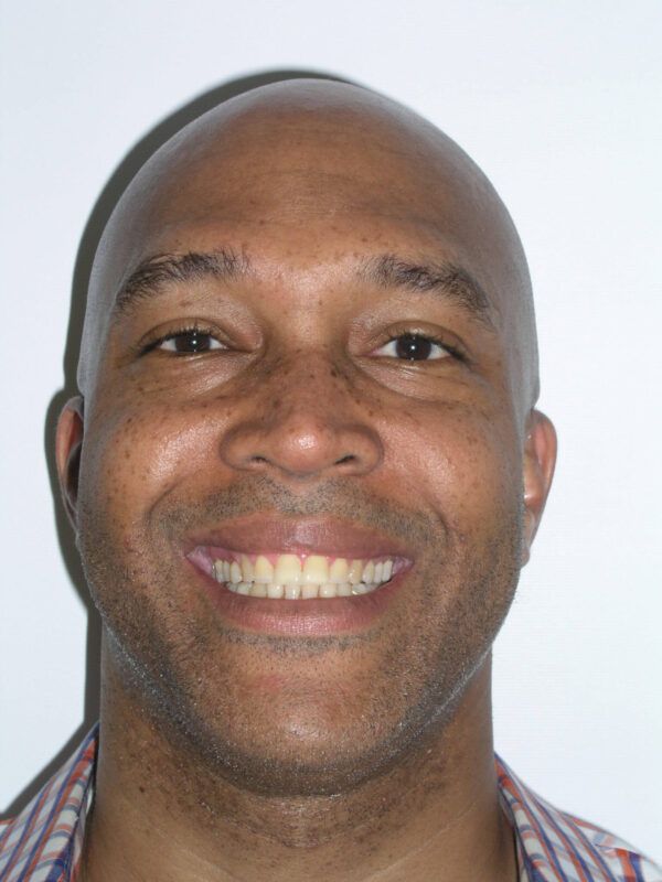 Adult Comprehensive Treatment After