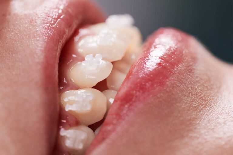 beautiful woman's smile with white healthy teeth