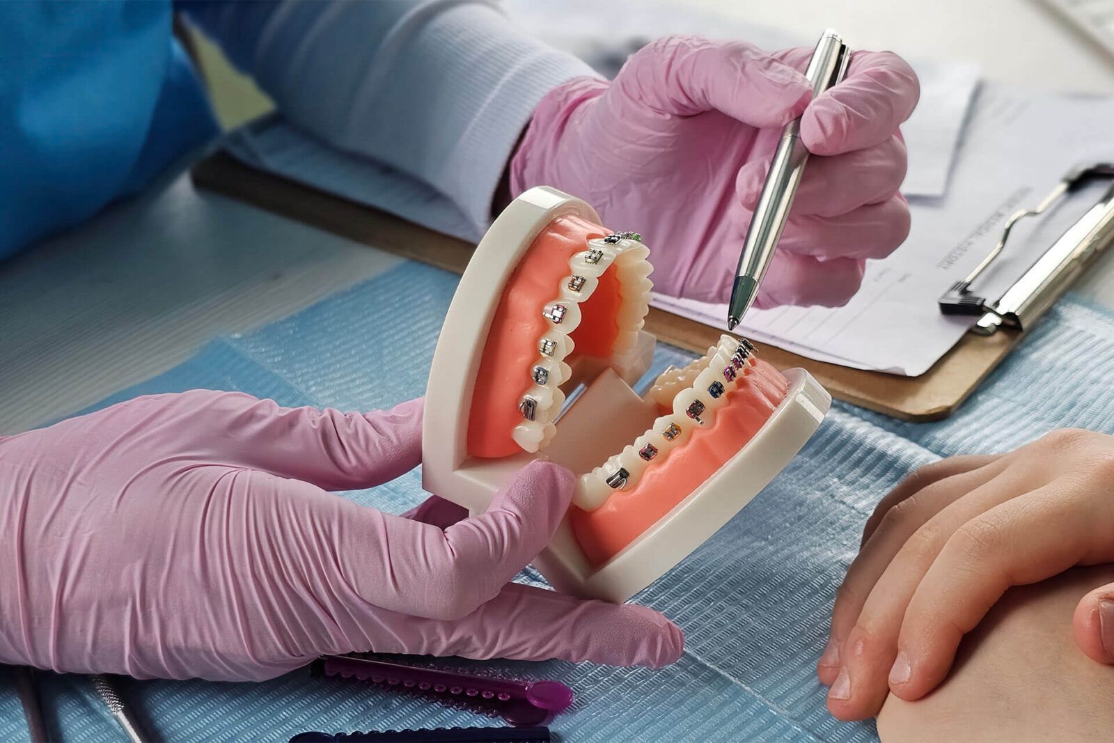 Demonstration of dental braces on a model during an orthodontic consultation
