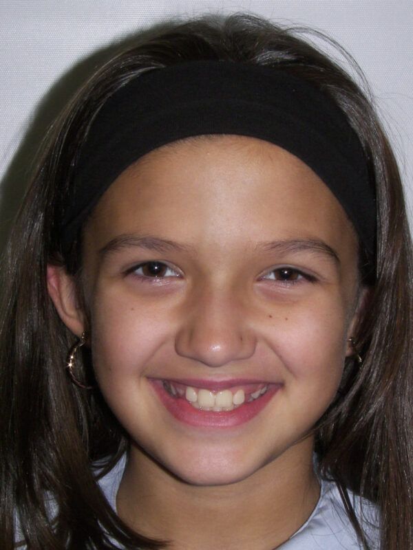 Phase 1 Treatment After