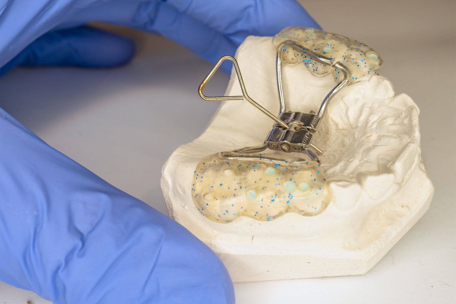 Dentist check in fingers patient teeth model with Hyrax Expander braces