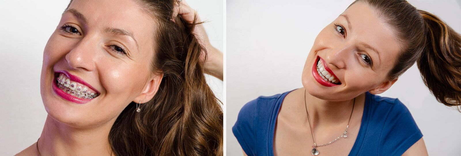 Young charismatic woman , before and after dental braces