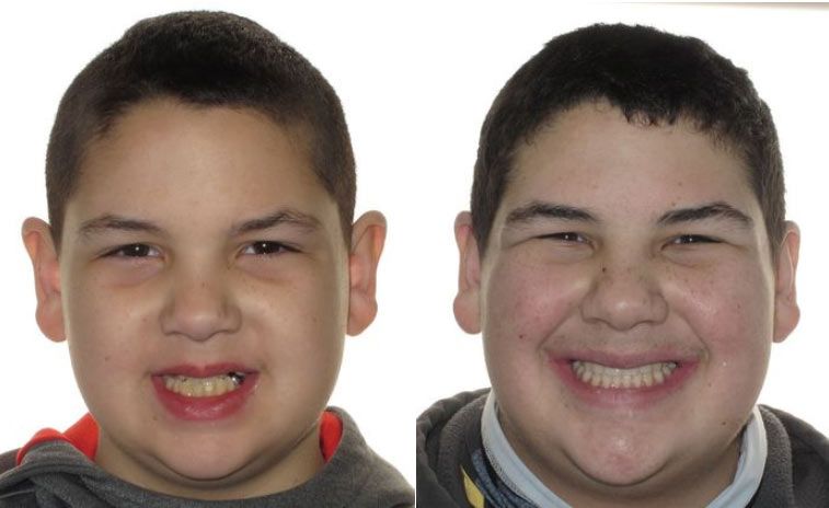 Cole Before and After 2