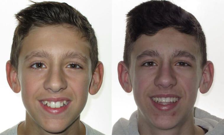 Dominic Before & After 4