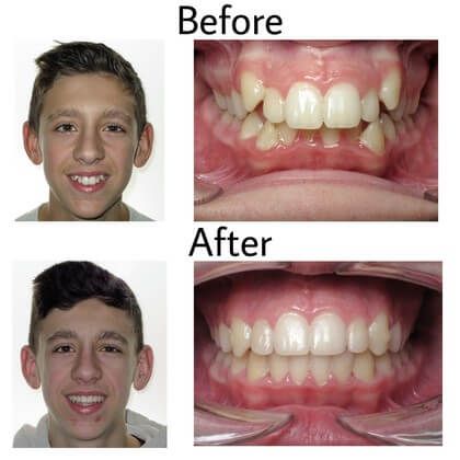 Dominic Before & After_1576012091