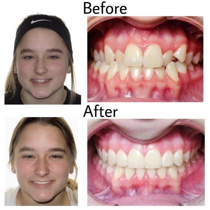 Karis Before and After