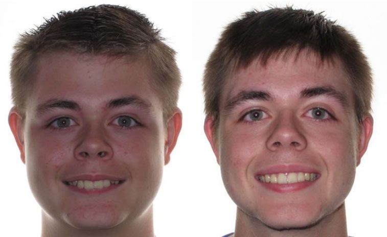 Parker Before and After 4