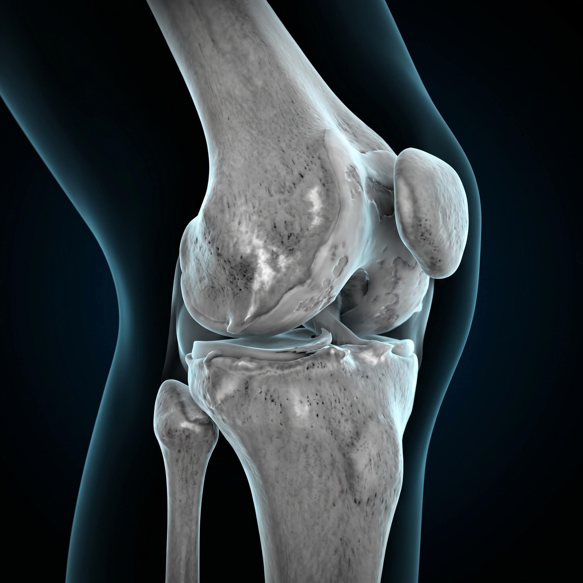 3D medical visualization of post-traumatic joint damage