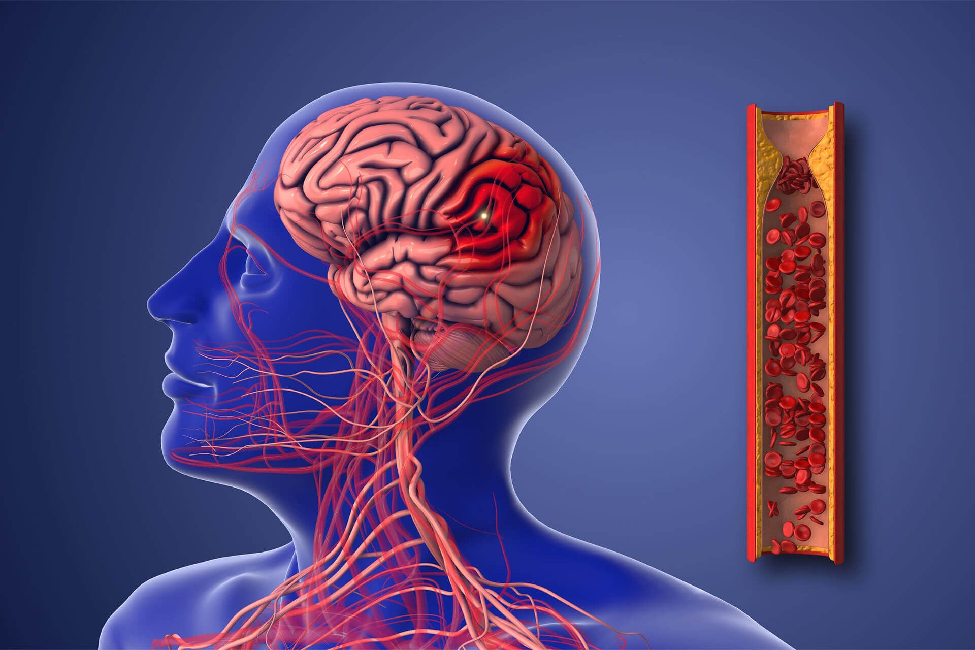 Brain diagram
