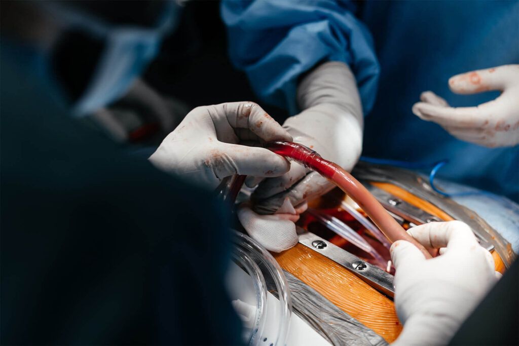 Close-up of a surgical procedure involving blood vessels or cardiovascular surgery