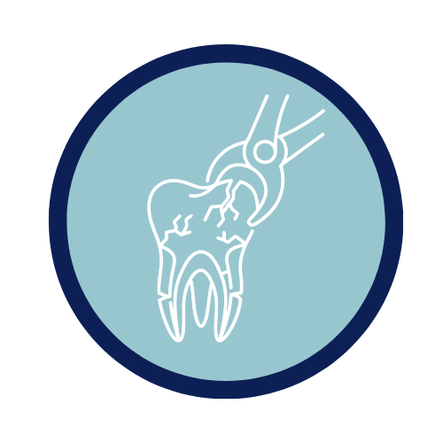 Complicated Extractions