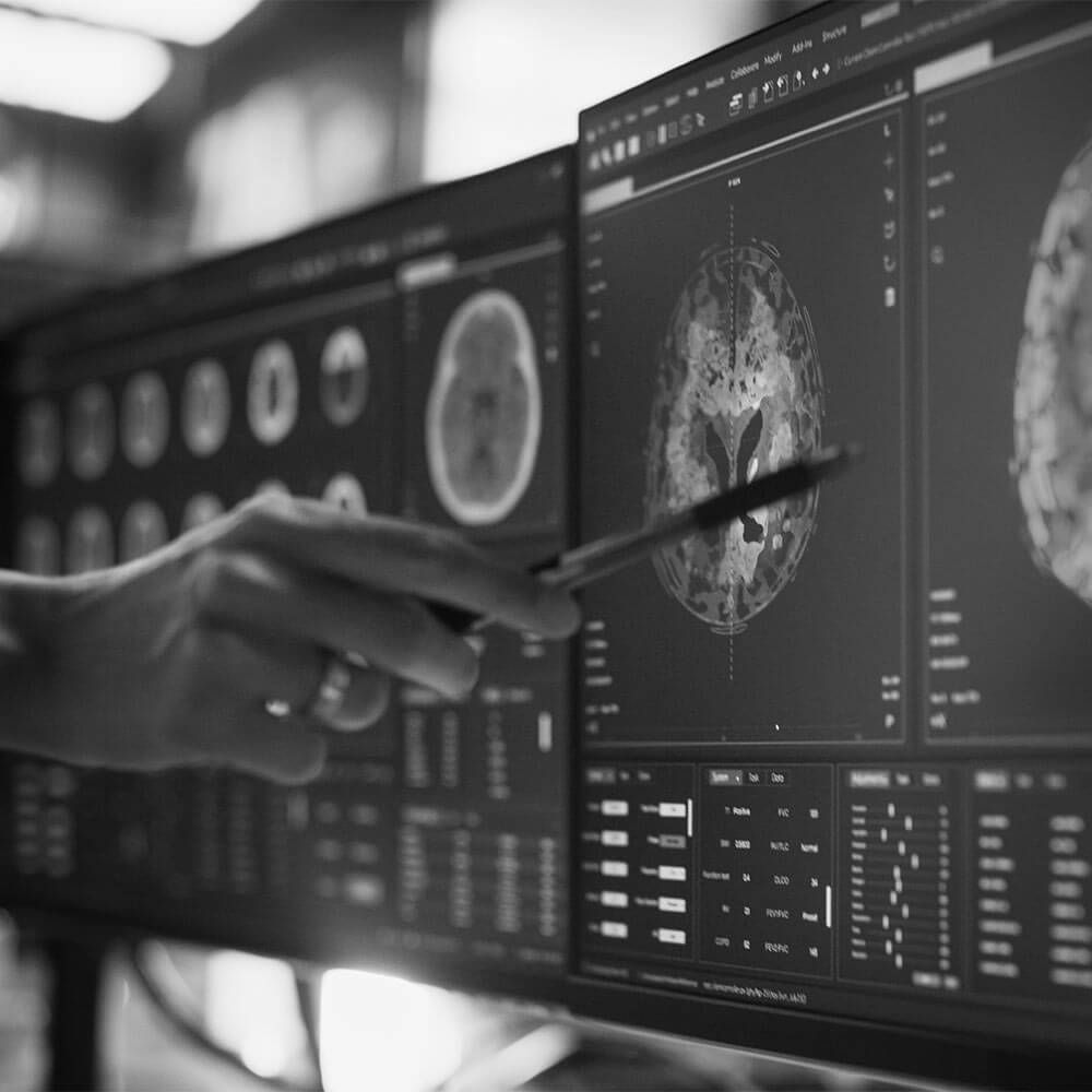 Anonymous Doctor Pointing At Desktop Computer Monitor With CT Scan Of Patient's Spinal Cord