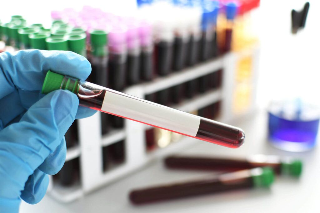 Comprehensive Lab and Advanced Image Screening