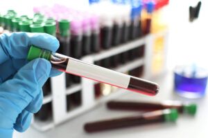 Comprehensive Lab and Advanced Image Screening