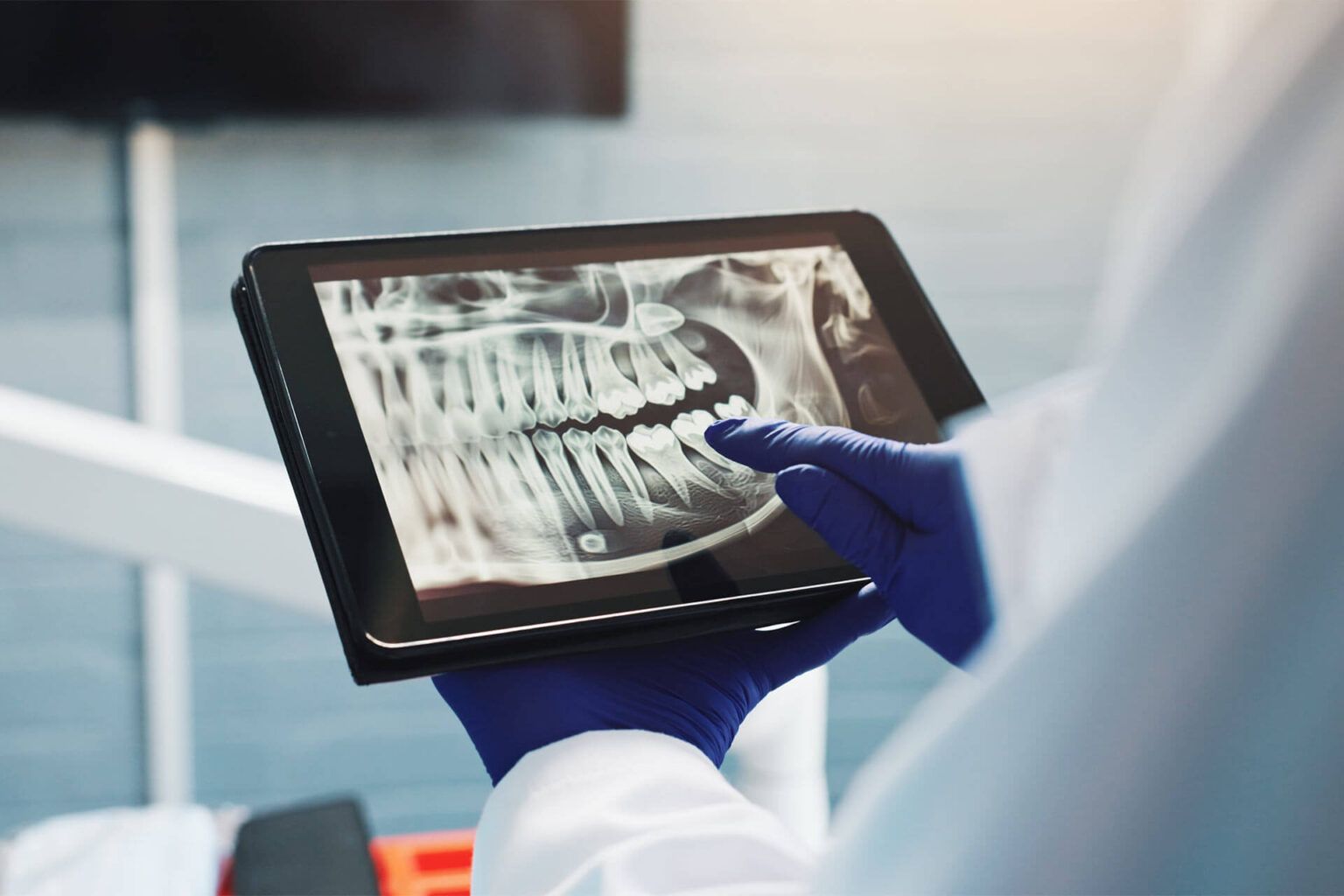 Oral Cancer Screening