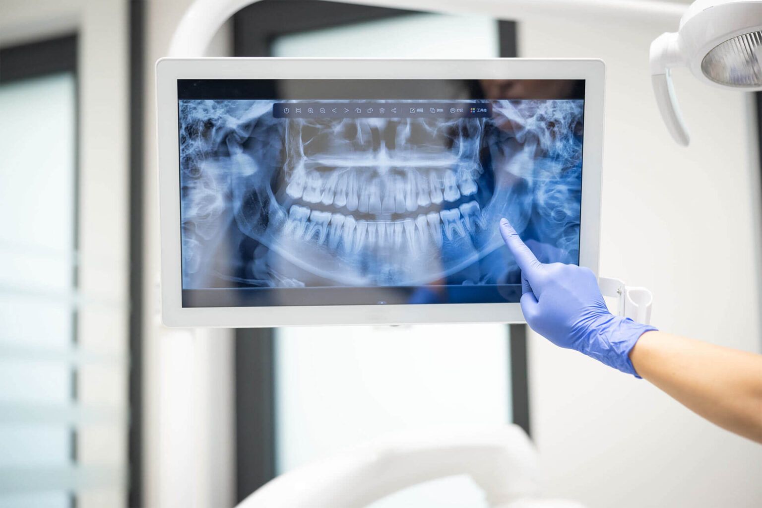 A dental professional wearing gloves points to a dental X-ray displayed on a monitor.