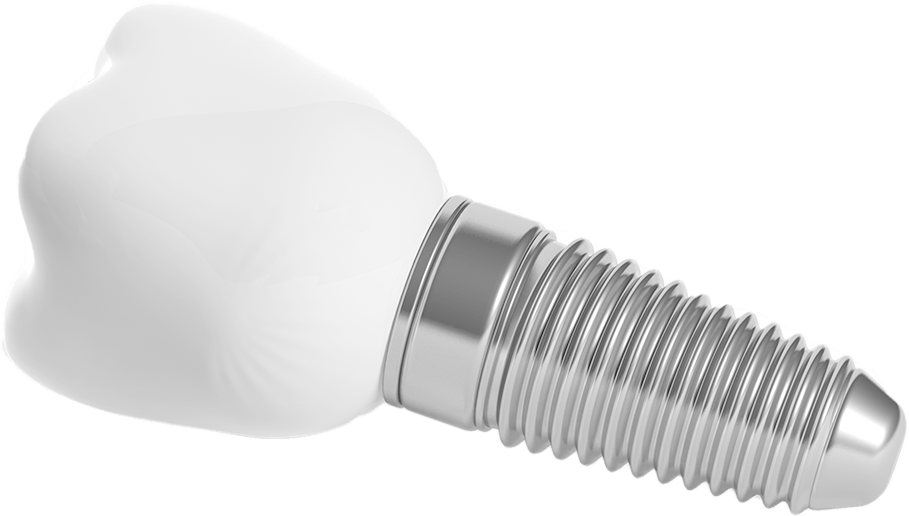 dental implant-isolated