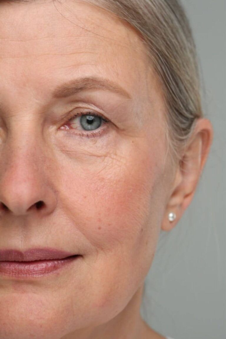 before face rejuvenation