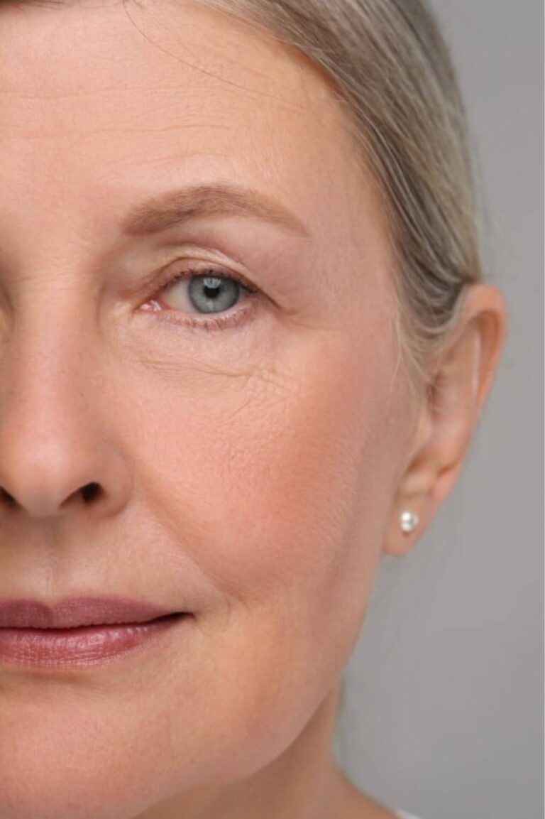 after face rejuvenation