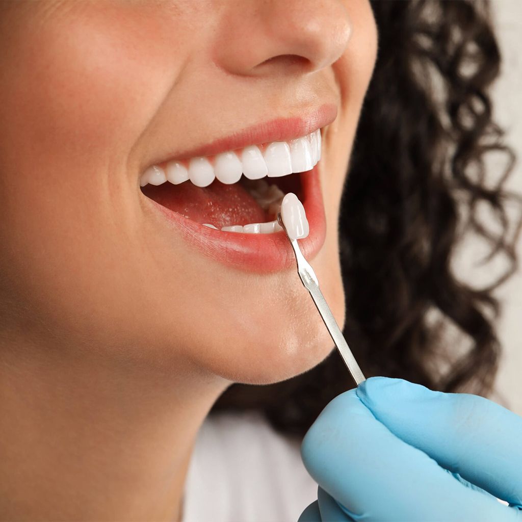 Doctor checking young woman's teeth color on light grey background, closeup. Dental veneers