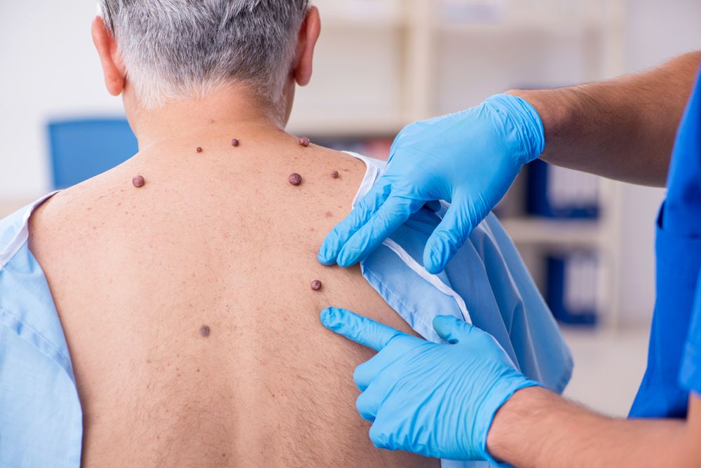 Old man visiting young male doctor dermatologist