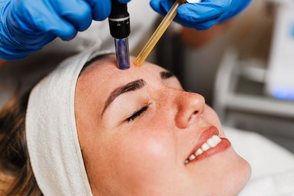 Beautician wearing blue gloves uses a microneedling pen to apply serum to forehead of client with closed eyes lying on a treatment table during a beauty spa procedure. Modern anti-age procedure.