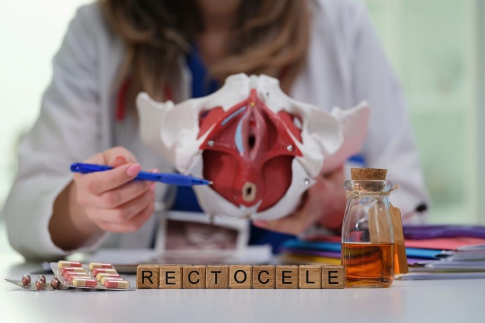 Detailed view of a pelvic model explaining rectocele, showcasing female reproductive and digestive systems.
