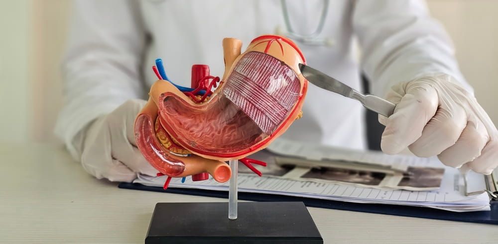 Surgeon held scalpel over an anatomical model of human stomach.