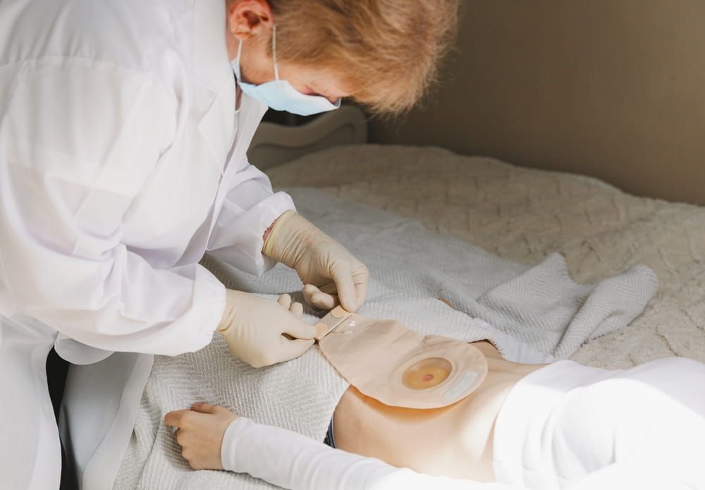 An adult nurse changes a patient's colostomy bag.