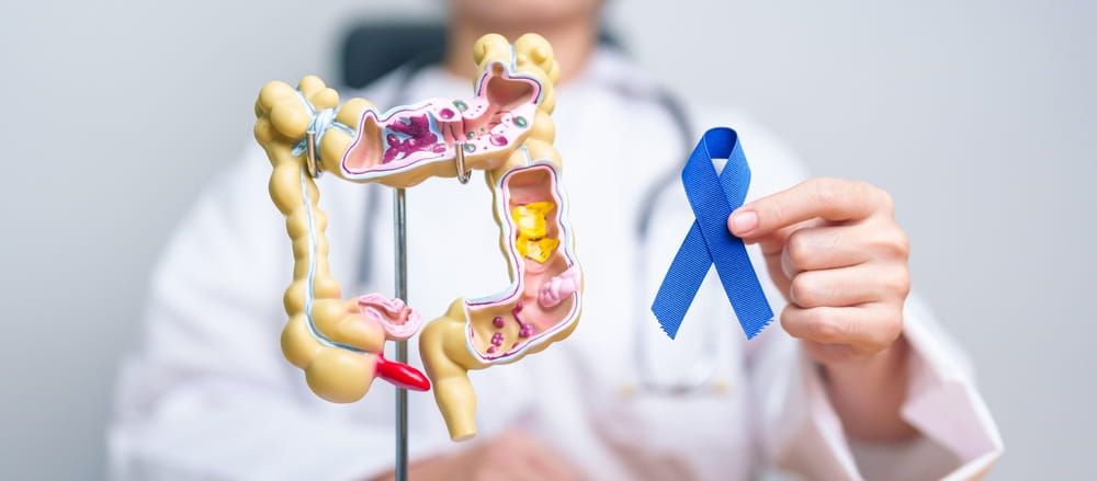 Colorectal Cancer Awareness month, Colonic disease, Large Intestine, Ulcerative colitis, Digestive system and Health concep
