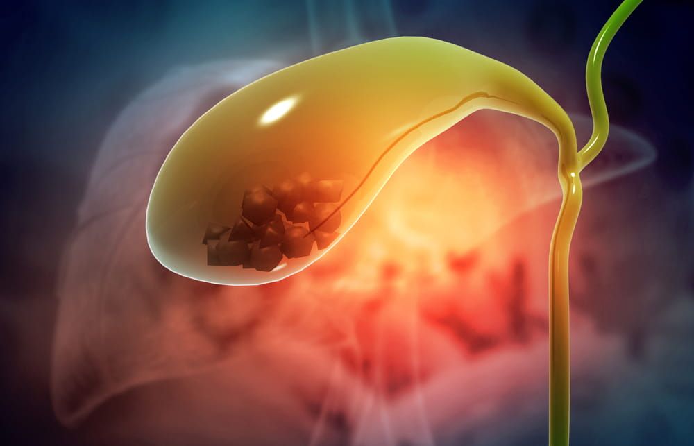Gallbladder with stone. 3d illustration