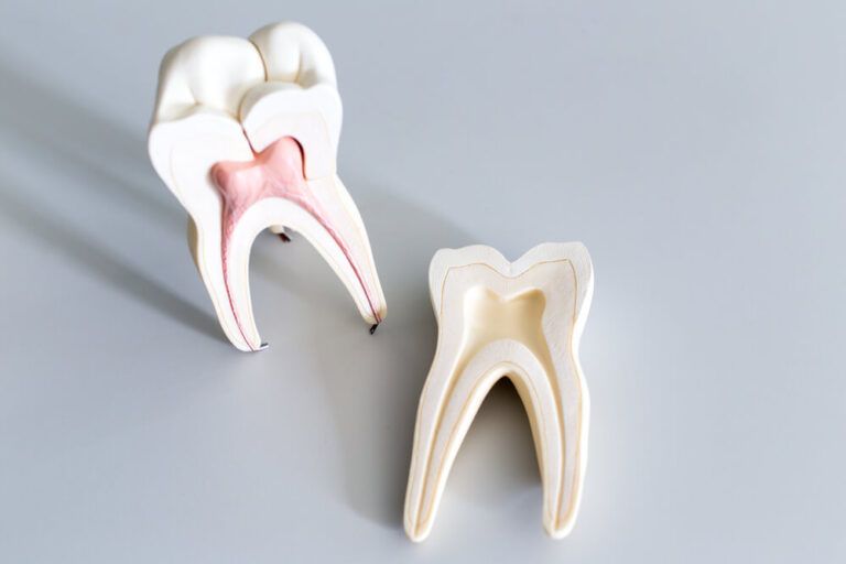 Root Canal Treatment