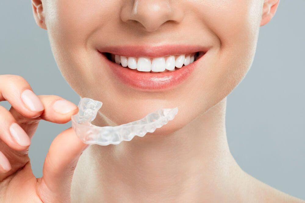 lady holding invisalign tray and smiling