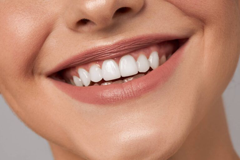 Beautiful smile with whitening teeth