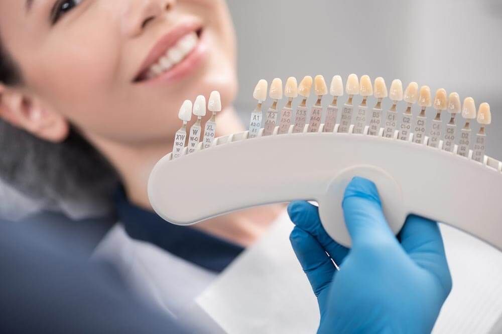 a patient undergoing a shade matching procedure for dental veneers