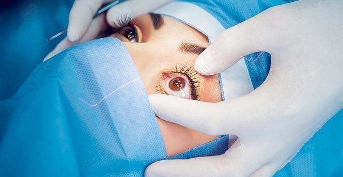 Eye Surgery