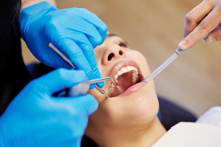 Periodontal Scaling & Root Planning