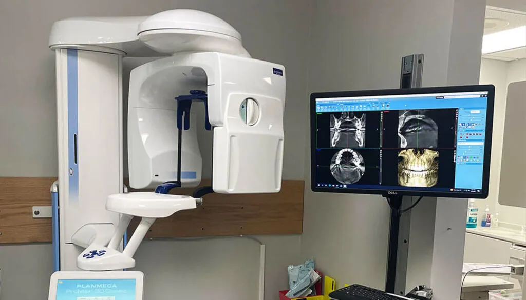 Cone Beam Computed Tomography -CBCT