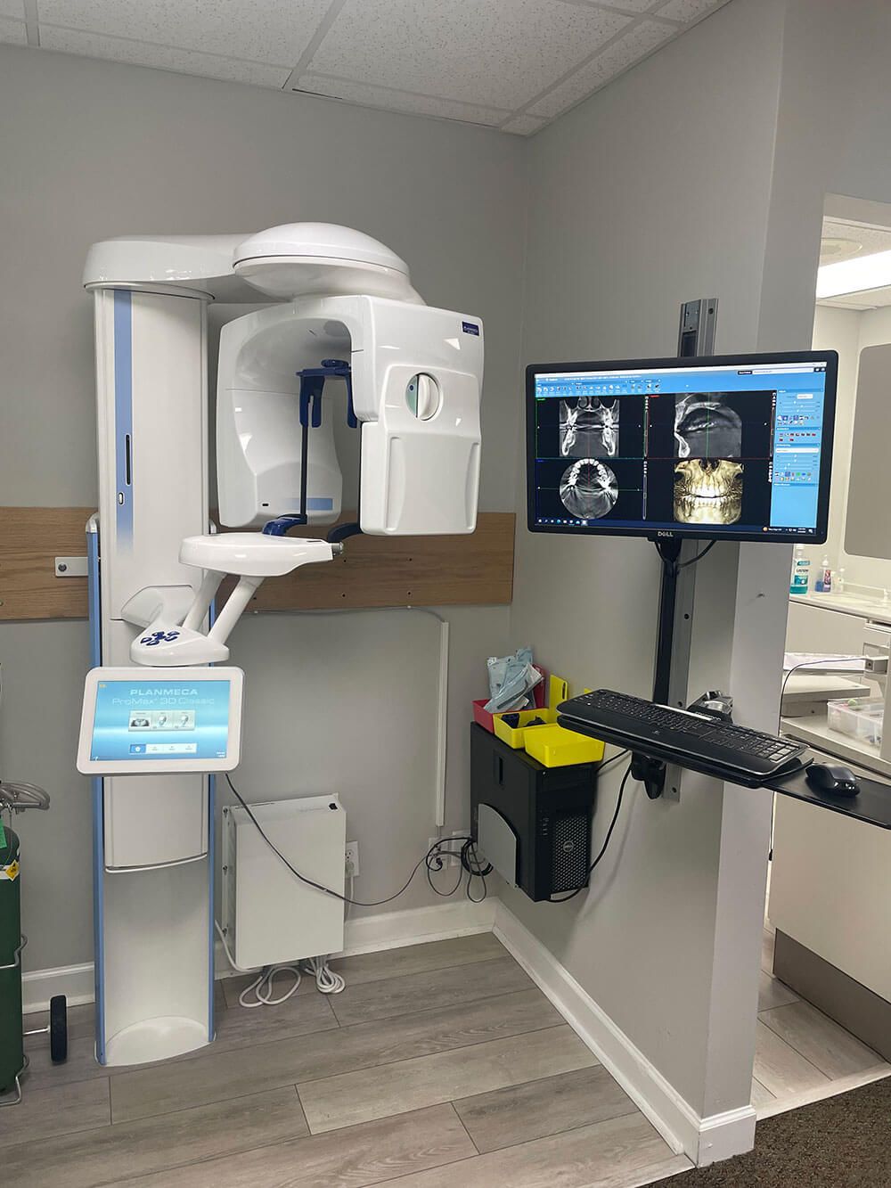 Cone Beam Computed Tomography -CBCT