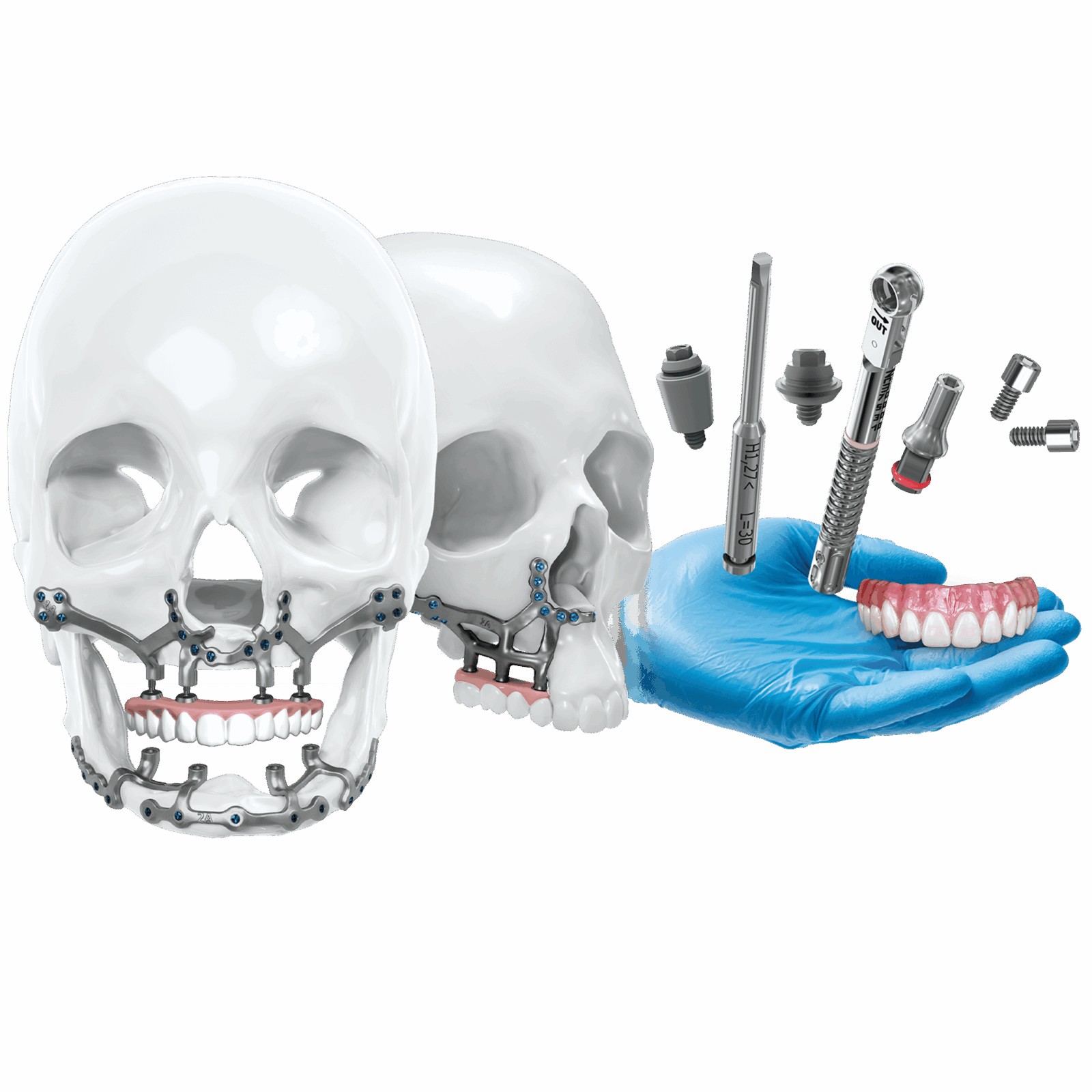 IPS® Preprosthetic Bundle - transparent bg