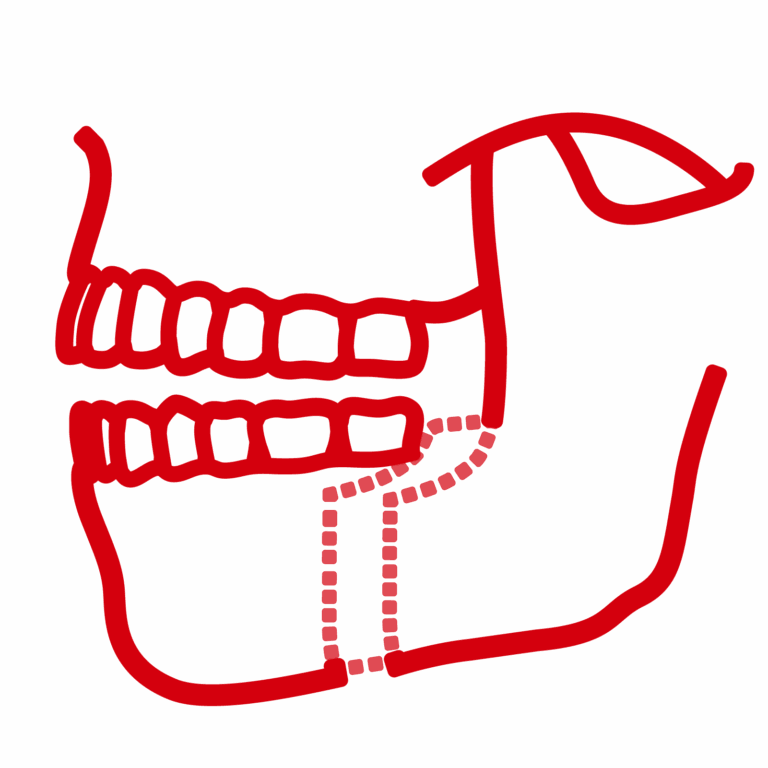 Orthognathic surgery icon