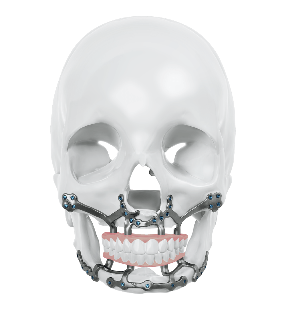 casestudies-Atrophic Maxilla and Atrophic Mandible