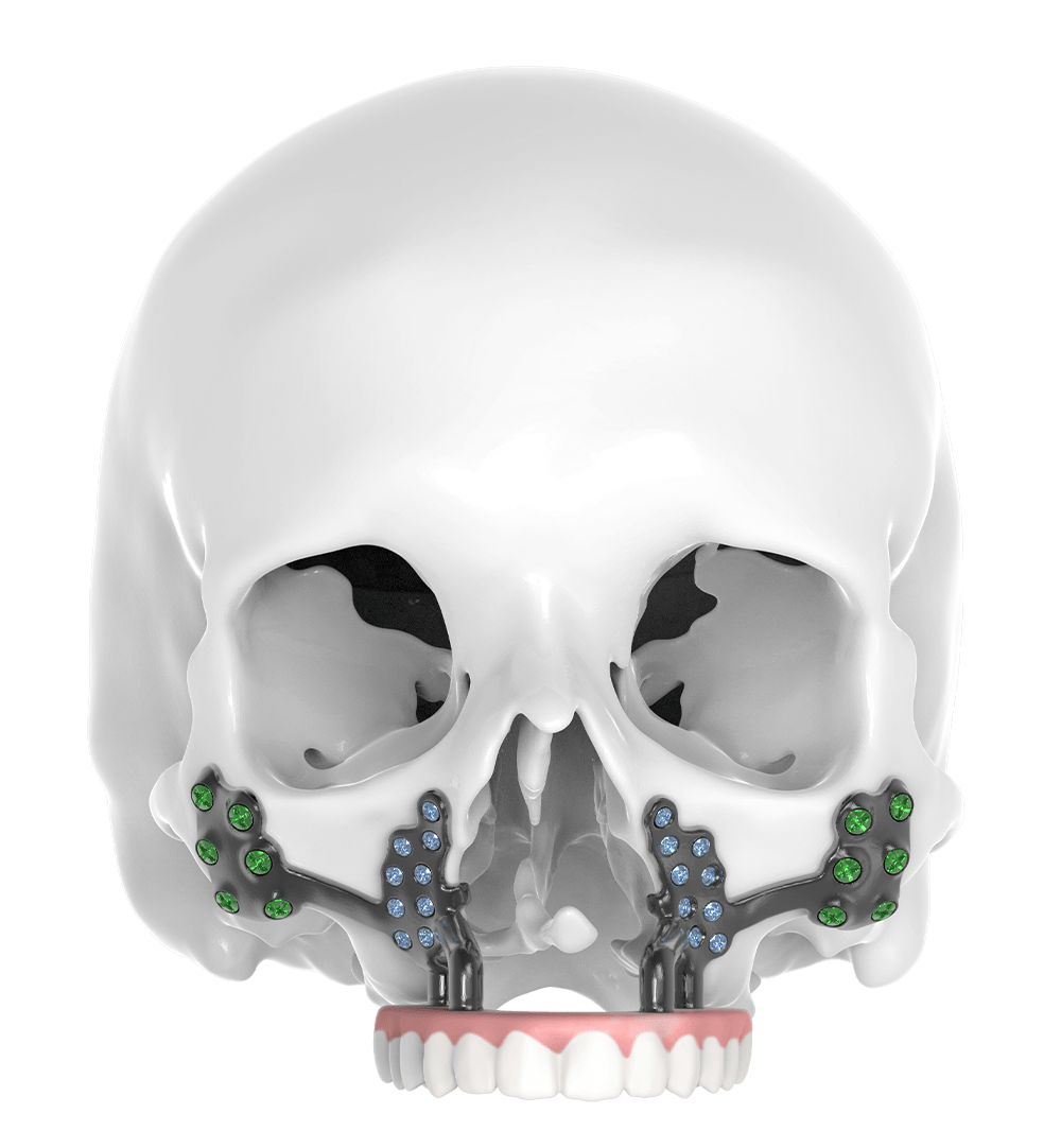 casestudies-cleft palate