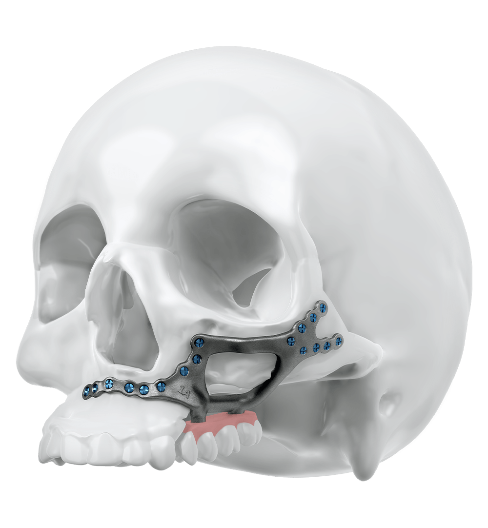 casestudies-Maxillary Resections